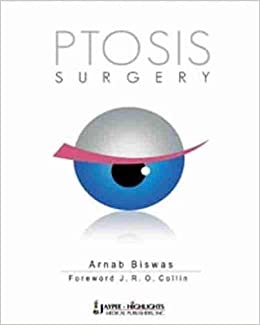 PTOSIS Surgery