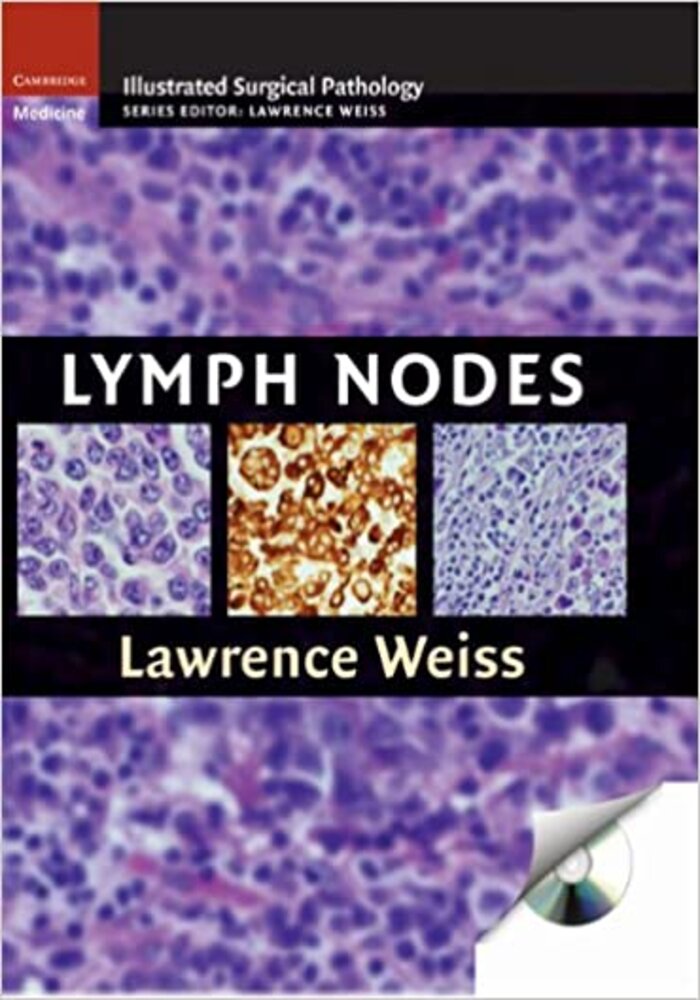 Lymph Nodes: illustrated surgical pathology (with-CD)