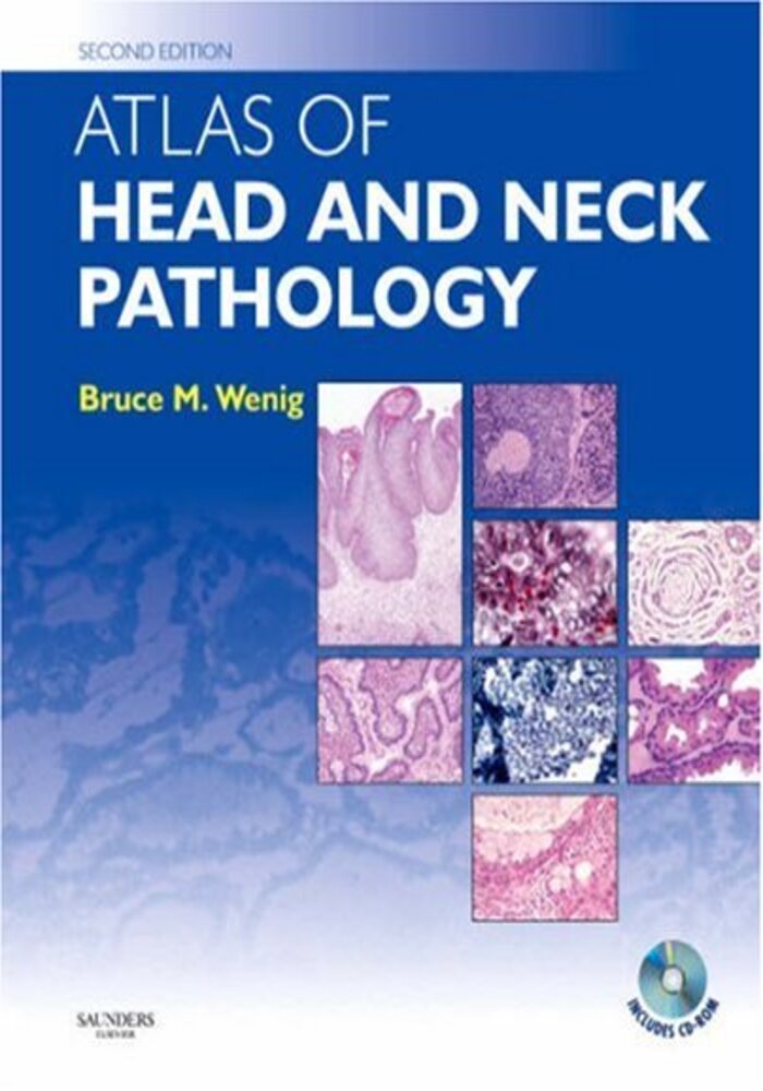 Atlas of Head and Neck Pathology