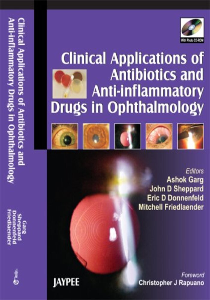 Clinical Applications of Antibiotics and Anti-inflammatory Drugs in Ophthalmology (with CD)