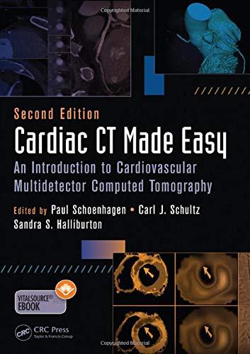 Cardiac CT Made Easy: An Introduction to Cardiovascular Multidetector Computed Tomography (H)